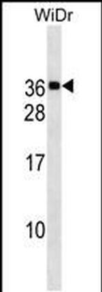 MED30 Antibody in Western Blot (WB)