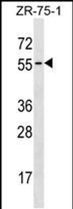 TCN1 Antibody in Western Blot (WB)