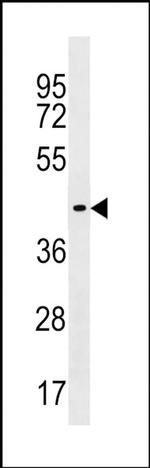 ZNF662 Antibody in Western Blot (WB)