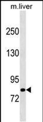 Cbl-b Antibody in Western Blot (WB)