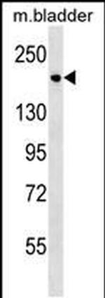 Sash1 Antibody in Western Blot (WB)