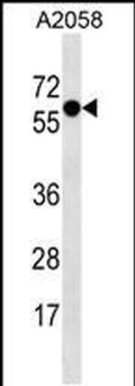Synaptotagmin 4 Antibody in Western Blot (WB)