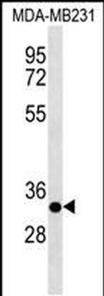 CAPNS2 Antibody in Western Blot (WB)