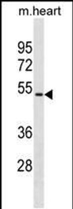 HOXA10 Antibody in Western Blot (WB)