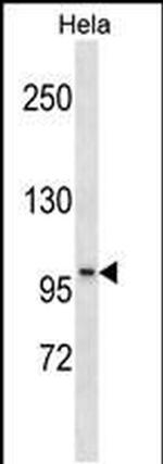 SSH1 Antibody in Western Blot (WB)