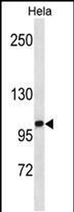 ZHX1 Antibody in Western Blot (WB)