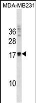 ANKRD37 Antibody in Western Blot (WB)