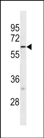 FUT10 Antibody in Western Blot (WB)