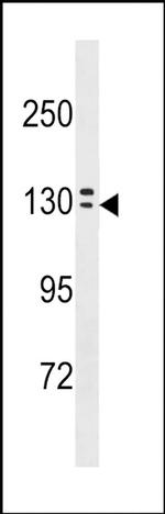 OVCH1 Antibody in Western Blot (WB)