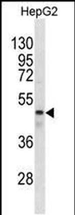 GABRR1 Antibody in Western Blot (WB)
