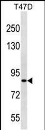 ZNF43 Antibody in Western Blot (WB)