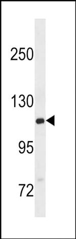 GTF2IRD2B Antibody in Western Blot (WB)