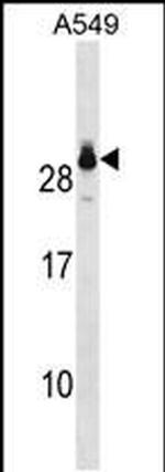 GSTT2 Antibody in Western Blot (WB)