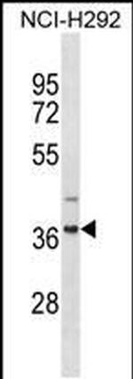 ZNF696 Antibody in Western Blot (WB)