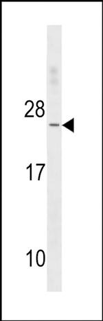 TNNC2 Antibody in Western Blot (WB)