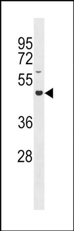 GLT8D4 Antibody in Western Blot (WB)