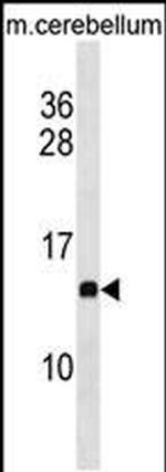 PFDN2 Antibody in Western Blot (WB)