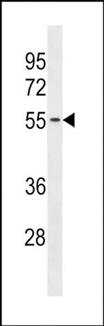 TMX3 Antibody in Western Blot (WB)