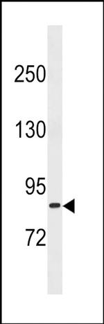 TXNRD3 Antibody in Western Blot (WB)