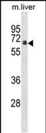GGT1 Antibody in Western Blot (WB)