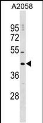 DNAJC25 Antibody in Western Blot (WB)