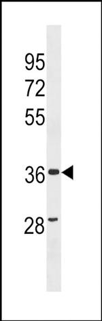 ZC3HAV1L Antibody in Western Blot (WB)