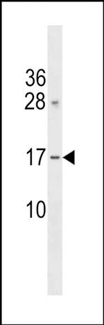 GAPT Antibody in Western Blot (WB)