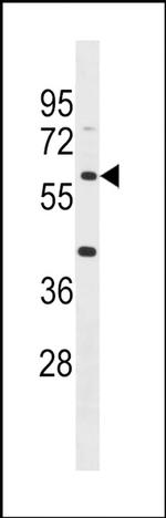ACSM4 Antibody in Western Blot (WB)