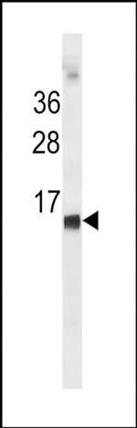 HBE1 Antibody in Western Blot (WB)