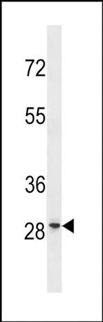 GRRP1 Antibody in Western Blot (WB)