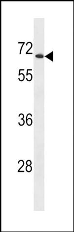 UGT2B28 Antibody in Western Blot (WB)