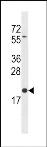 BLOC1S3 Antibody in Western Blot (WB)