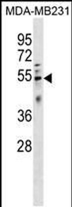 HTRA4 Antibody in Western Blot (WB)