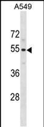 PUS10 Antibody in Western Blot (WB)