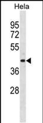 ADPRH Antibody in Western Blot (WB)