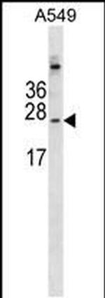 CALML6 Antibody in Western Blot (WB)