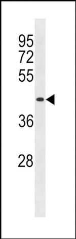 DIRC2 Antibody in Western Blot (WB)