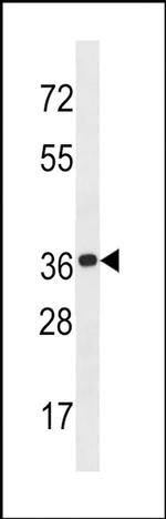 KCTD20 Antibody in Western Blot (WB)