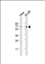 PIGB Antibody in Western Blot (WB)