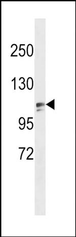 ZNF516 Antibody in Western Blot (WB)
