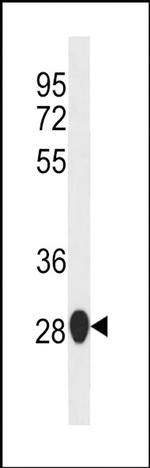 SIKE Antibody in Western Blot (WB)