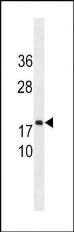 C8orf44 Antibody in Western Blot (WB)
