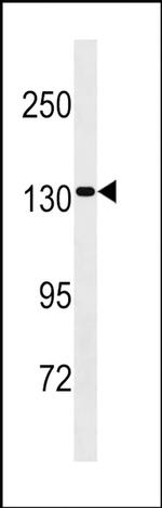 SAPS2 Antibody in Western Blot (WB)