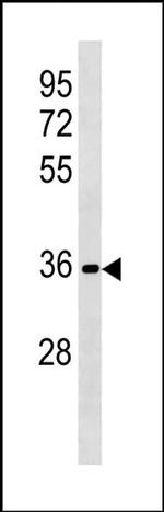 RFPL3 Antibody in Western Blot (WB)