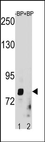 ZMAT1 Antibody in Western Blot (WB)