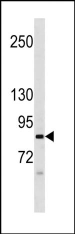 NAALAD2 Antibody in Western Blot (WB)