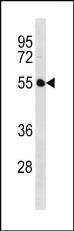 IGSF21 Antibody in Western Blot (WB)
