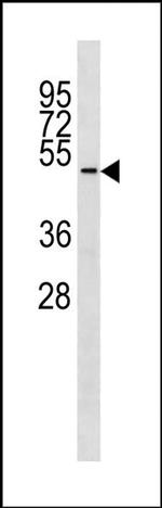 TUBD1 Antibody in Western Blot (WB)