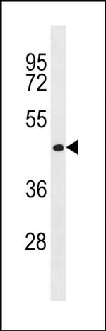 CWC27 Antibody in Western Blot (WB)