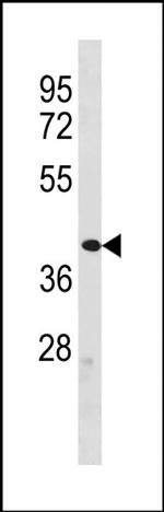 ZFP92 Antibody in Western Blot (WB)
